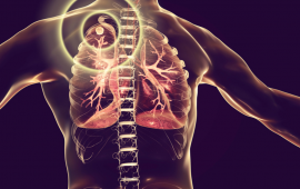 x-ray image of lung 