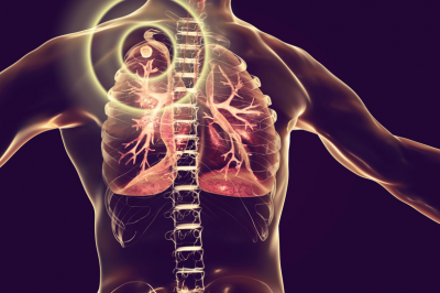 x-ray image of lung 