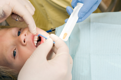 child receiving fluoride treatment